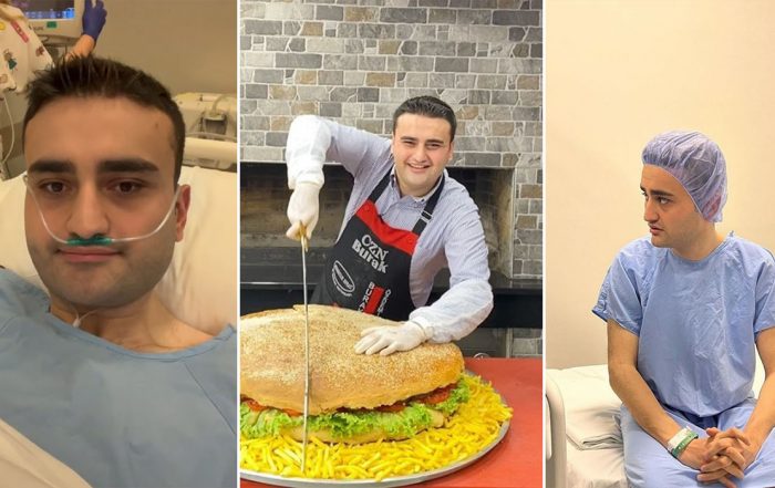 chef burak sakit