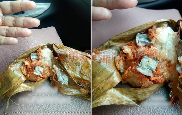 ubat stapler dalam makanan
