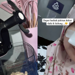 Wanita Kongsi Detik Cemas Pisau Blender ‘Terpelanting’ Ke Muka, Bahaya Kalau Silap Guna!